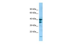 Aviva Systems Biology Corp P2RY13 Antibody - C-terminal region (ARP64924_P050)