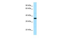Aviva Systems Biology Corp CAPZA1 Antibody - N-terminal region (ARP64942_P050)