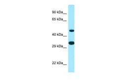 Aviva Systems Biology Corp SCD5 Antibody - C-terminal region (ARP65045_P050)