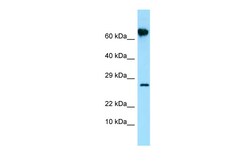 Aviva Systems Biology Corp FKBP10 Antibody - N-terminal region (ARP65076_P050)