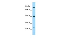Aviva Systems Biology Corp NMUR1 Antibody - C-terminal region (ARP65093_P050)