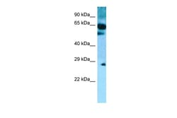 Aviva Systems Biology Corp SLC22A9 Antibody - C-terminal region (ARP65101_P050)