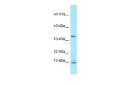 Aviva Systems Biology Corp PDE6G Antibody - N-terminal region (ARP65136_P050)