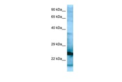 Aviva Systems Biology Corp RPL15 Antibody - N-terminal region (ARP65141_P050)
