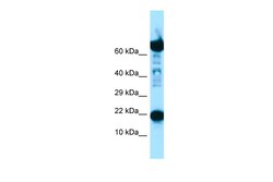Aviva Systems Biology Corp RPS11 Antibody - C-terminal region (ARP65143_P050)