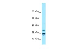 Aviva Systems Biology Corp RPS11 Antibody - N-terminal region (ARP65144_P050)