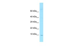 Aviva Systems Biology Corp FKBP1A Antibody - N-terminal region (ARP65167_P050)
