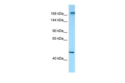Aviva Systems Biology Corp MYOM1 Antibody - C-terminal region (ARP65177_P050)