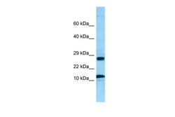 Aviva Systems Biology Corp RPL21 Antibody - middle region (ARP65195_P050)