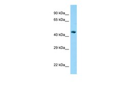Aviva Systems Biology Corp AP1M1 Antibody - C-terminal region (ARP65292_P050)