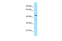 Aviva Systems Biology Corp HCRTR1 Antibody - C-terminal region (ARP65328_P050)