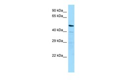 Aviva Systems Biology Corp MATN4 Antibody - N-terminal region (ARP65342_P050)