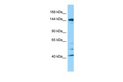 Aviva Systems Biology Corp ITSN2 Antibody - C-terminal region (ARP65456_P050)
