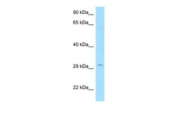 Aviva Systems Biology Corp RTP1 Antibody - N-terminal region (ARP65494_P050)