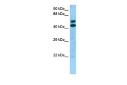 Aviva Systems Biology Corp STK19 Antibody - middle region (ARP65510_P050)