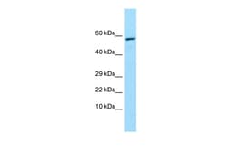 Aviva Systems Biology Corp TREH Antibody - middle region (ARP65519_P050)