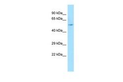 Aviva Systems Biology Corp ARHGAP8 Antibody - middle region (ARP65532_P050)