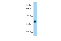 Aviva Systems Biology Corp CH25H Antibody - C-terminal region (ARP65536_P050)
