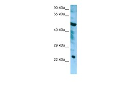 Aviva Systems Biology Corp CHMP6 Antibody - middle region (ARP65538_P050)