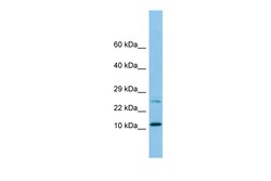 Aviva Systems Biology Corp DYNLRB1 Antibody - N-terminal region (ARP65558_P050)
