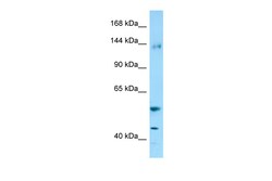 Aviva Systems Biology Corp ENPEP Antibody - C-terminal region (ARP65562_P050)