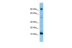 Aviva Systems Biology Corp FABP9 Antibody - middle region (ARP65665_P050)