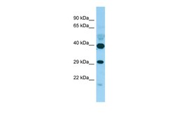 Aviva Systems Biology Corp PISD Antibody - C-terminal region (ARP65690_P050)