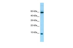 Aviva Systems Biology Corp S100A7A Antibody - middle region (ARP65704_P050)