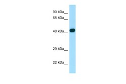 Aviva Systems Biology Corp ARPC1B Antibody - C-terminal region (ARP65734_P050)
