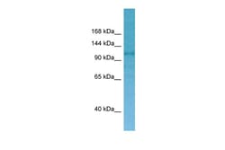 Aviva Systems Biology Corp CNKSR2 Antibody - C-terminal region (ARP65739_P050)