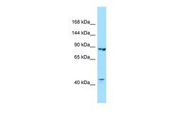 Aviva Systems Biology Corp IPO8 Antibody - C-terminal region (ARP65771_P050)