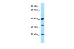 Aviva Systems Biology Corp KTI12 Antibody - C-terminal region (ARP65775_P050)