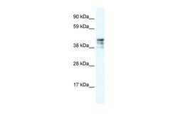 Aviva Systems Biology Corp KRT15 Antibody - C-terminal region (AVARP00005_P050)