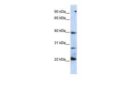 Aviva Systems Biology Corp TNFRSF10B Antibody - N-terminal region (AVARP00032_P050)