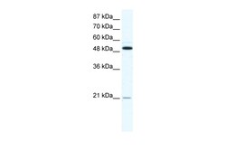 Aviva Systems Biology Corp TNFRSF11B Antibody - N-terminal region (AVARP00033_T100)