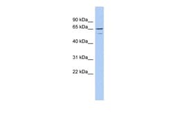 Aviva Systems Biology Corp TNFRSF1A Antibody - N-terminal region (AVARP00034_P050)