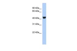 Aviva Systems Biology Corp TH Antibody - N-terminal region (AVARP01052_P050)