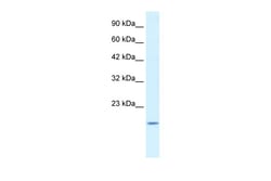 Aviva Systems Biology Corp BAX Antibody - N-terminal region (AVARP02020_T100)