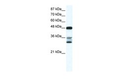 Aviva Systems Biology Corp TNFSF10 Antibody - N-terminal region (AVARP02040_P050)