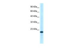Aviva Systems Biology Corp TNFRSF18 Antibody - C-terminal region (AVARP02052_P050)