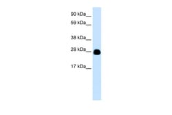 Aviva Systems Biology Corp YWHAH Antibody - N-terminal region (AVARP02061_P050)