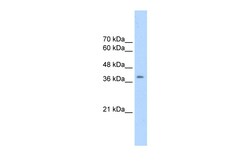 Aviva Systems Biology Corp CDK9 Antibody - N-terminal region (AVARP03004_T100)