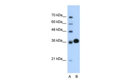 Aviva Systems Biology Corp CDK6 Antibody - C-terminal region (AVARP03005_T100)