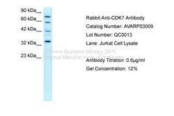 Aviva Systems Biology Corp CDK7 Antibody - C-terminal region (AVARP03009_T100)
