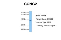 Aviva Systems Biology Corp CCNG2 Antibody - N-terminal region (AVARP03032_T100)