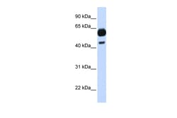 Aviva Systems Biology Corp CDC25A Antibody - middle region (AVARP03040_P050)