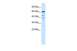 Aviva Systems Biology Corp CDC25B Antibody - N-terminal region (AVARP03041_P050)