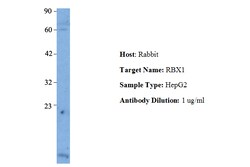 Aviva Systems Biology Corp RBX1 Antibody - middle region (AVARP03042_T100)