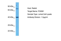 Aviva Systems Biology Corp FOXM1 Antibody - middle region (AVARP03043_P050)