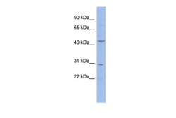 Aviva Systems Biology Corp CCNE2 Antibody - N-terminal region (AVARP03044_P050)